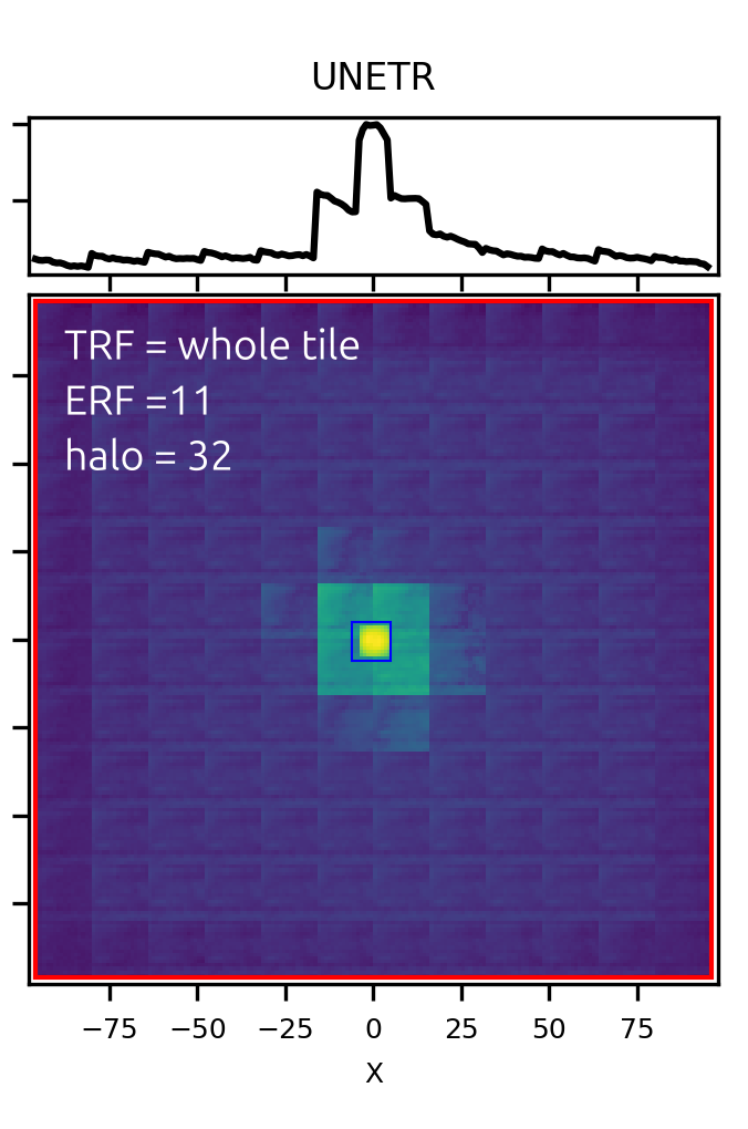 Receptive field UNETR